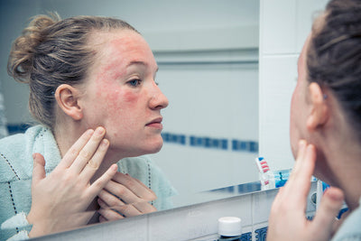 A skincare routine for eczema on the face and body