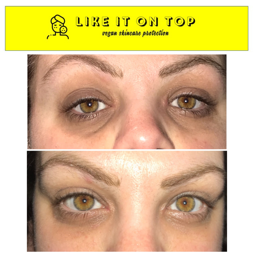 under eye protection