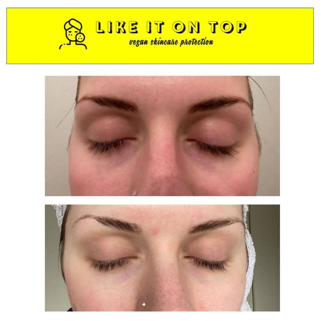 under eye protection