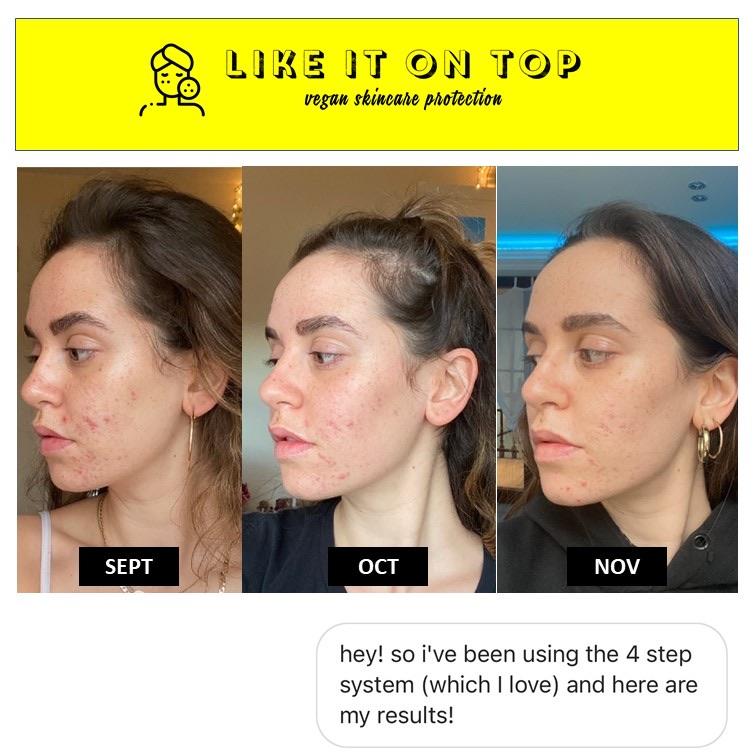 4-Step Kit