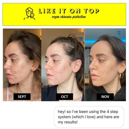4-Step Kit